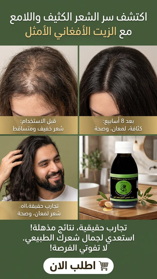 الزيت الأفغاني للشعر بعد الولادة - متجر الزيت الافغاني الامثل للشعر