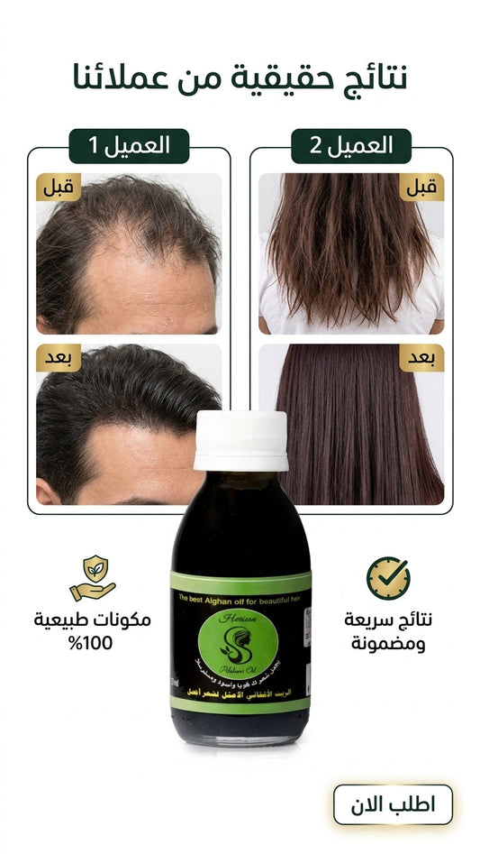 كيف تميز الزيت الأفغاني الأصلي من المقلد؟ - متجر الزيت الافغاني الامثل للشعر