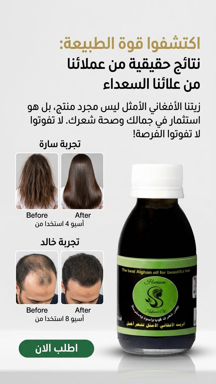 أفضل المبيعات APPPlaza: اكتشف أفضل المنتجات لدينا - 3600522263609 - متجر الزيت الافغاني الامثل للشعر