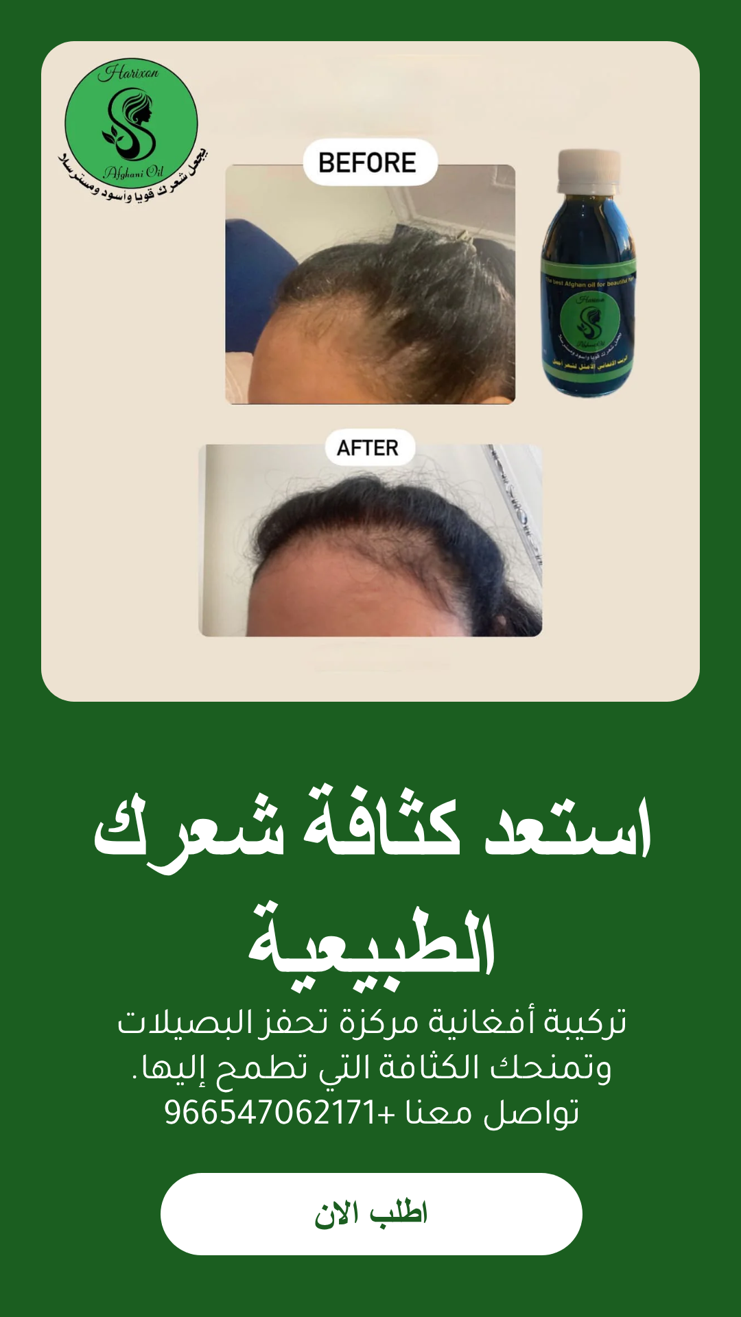 عرض زيت أفغاني محترف للعناية بالشعر مع مشط وشحن مجاني - الزيت الافغاني - متجر الزيت الافغاني الامثل للشعر