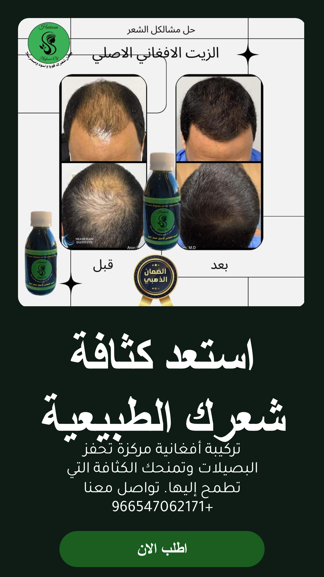 عرض زيت أفغاني محترف للعناية بالشعر مع مشط وشحن مجاني - الزيت الافغاني - متجر الزيت الافغاني الامثل للشعر