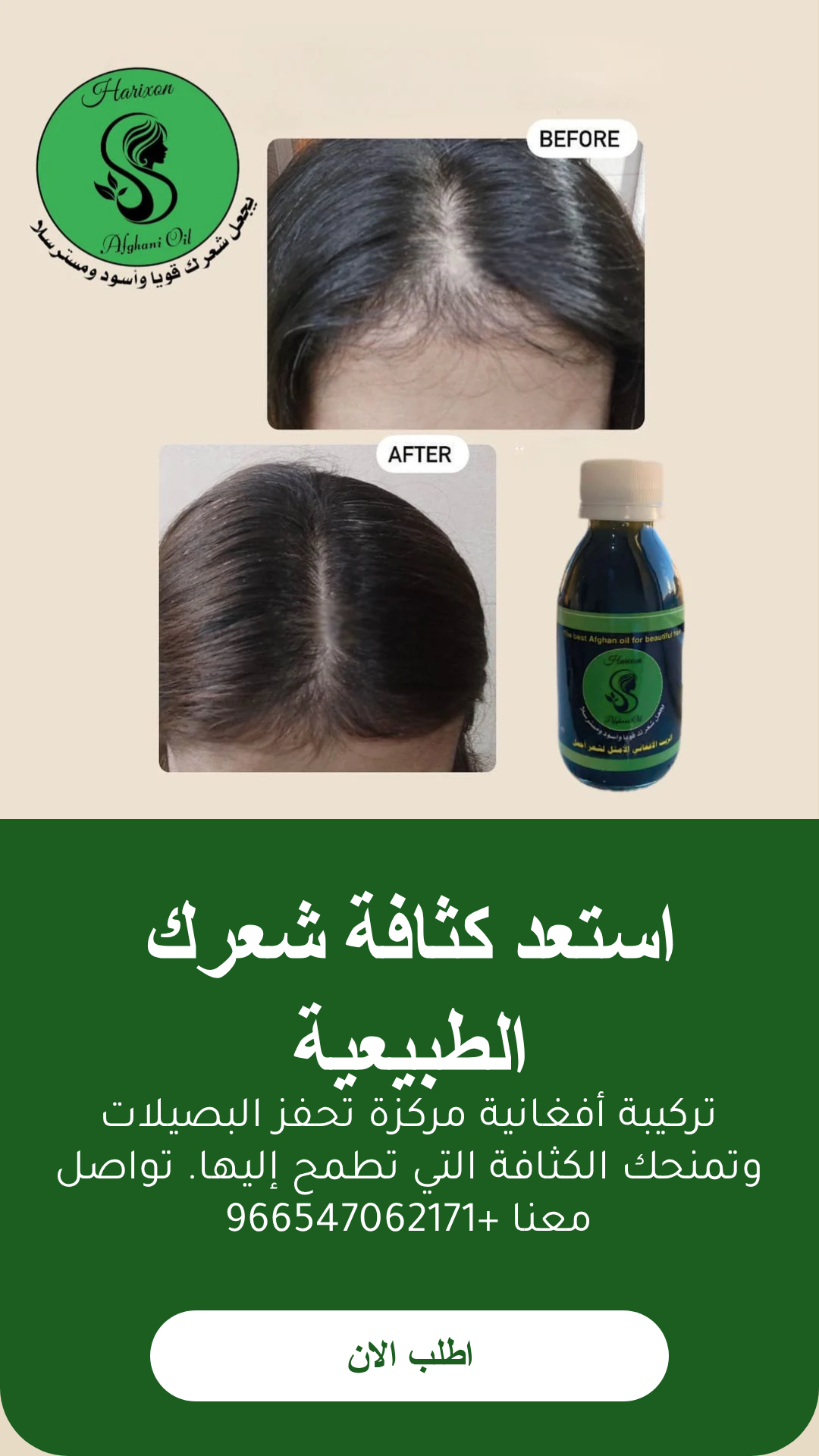 عرض علبة مع مشط توزيع الزيت الافغاني هدية - متجر الزيت الافغاني الامثل للشعر