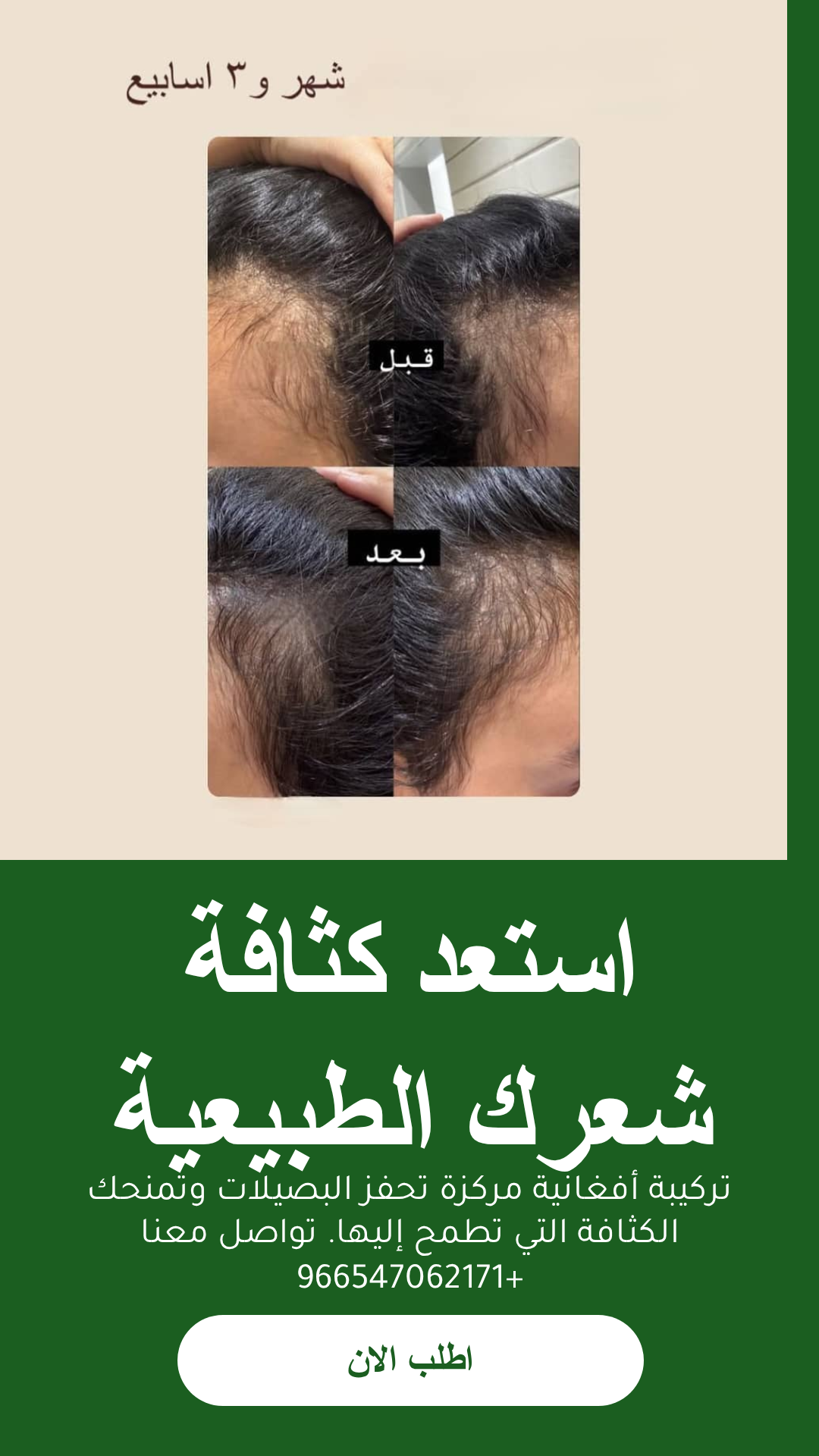 عرض زيت أفغاني محترف للعناية بالشعر مع مشط وشحن مجاني - الزيت الافغاني - متجر الزيت الافغاني الامثل للشعر