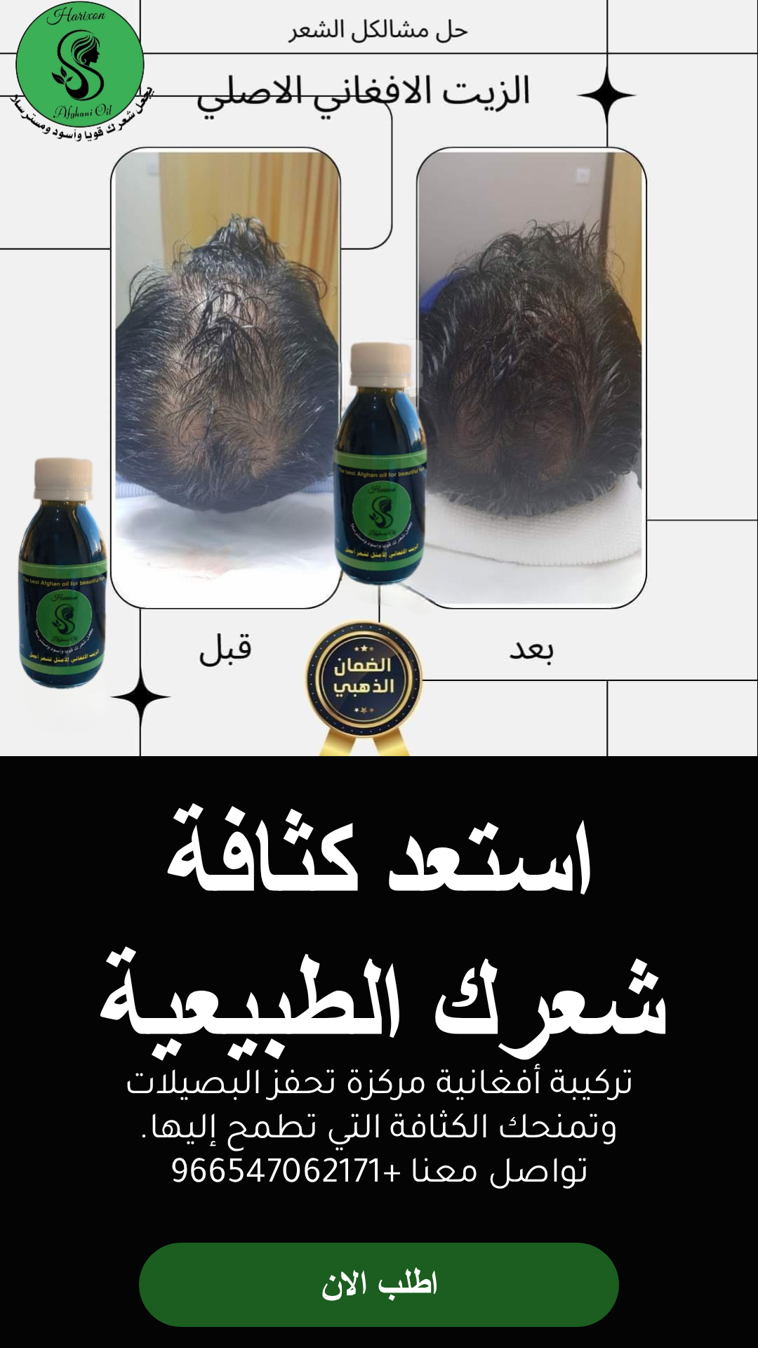 عرض زيت أفغاني محترف للعناية بالشعر مع مشط وشحن مجاني - الزيت الافغاني - متجر الزيت الافغاني الامثل للشعر