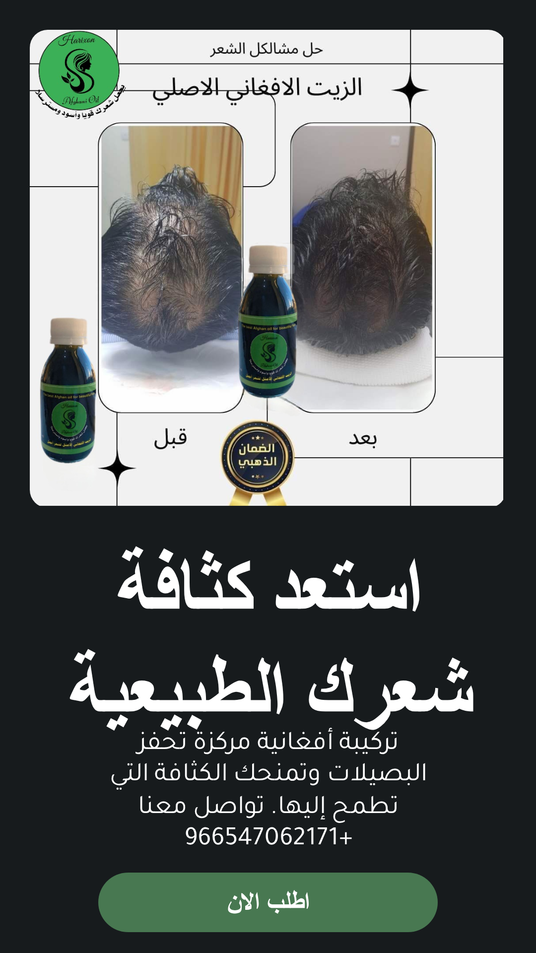 عرض علبة مع مشط توزيع الزيت الافغاني هدية - متجر الزيت الافغاني الامثل للشعر