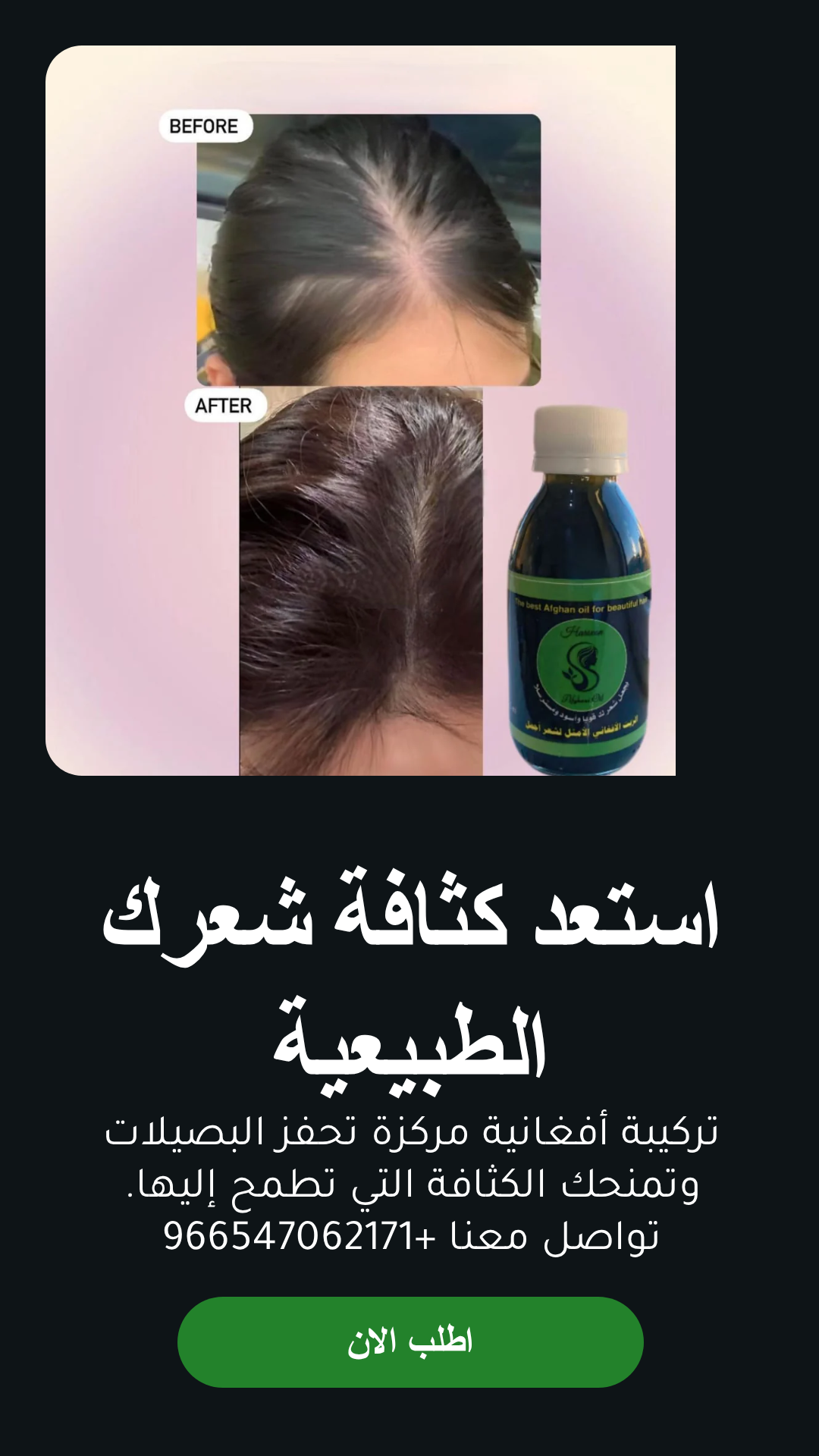 عرض زيت أفغاني محترف للعناية بالشعر مع مشط وشحن مجاني - الزيت الافغاني - متجر الزيت الافغاني الامثل للشعر