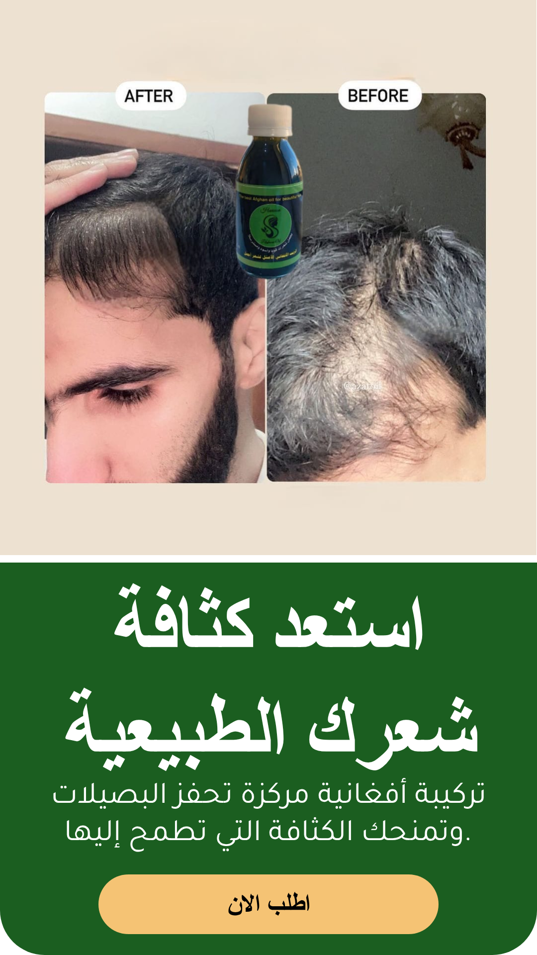 عرض زيت أفغاني محترف للعناية بالشعر مع مشط وشحن مجاني - الزيت الافغاني - متجر الزيت الافغاني الامثل للشعر