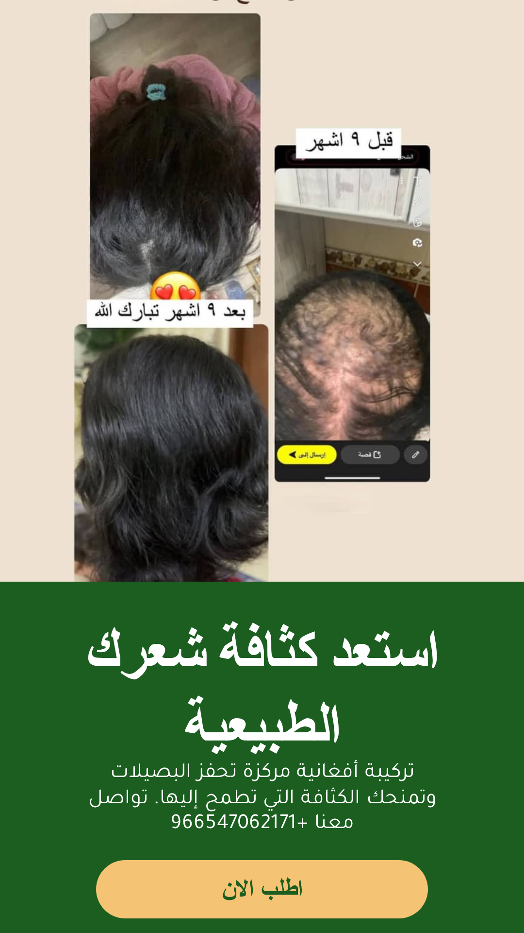 عرض زيت أفغاني محترف للعناية بالشعر مع مشط وشحن مجاني - الزيت الافغاني - متجر الزيت الافغاني الامثل للشعر
