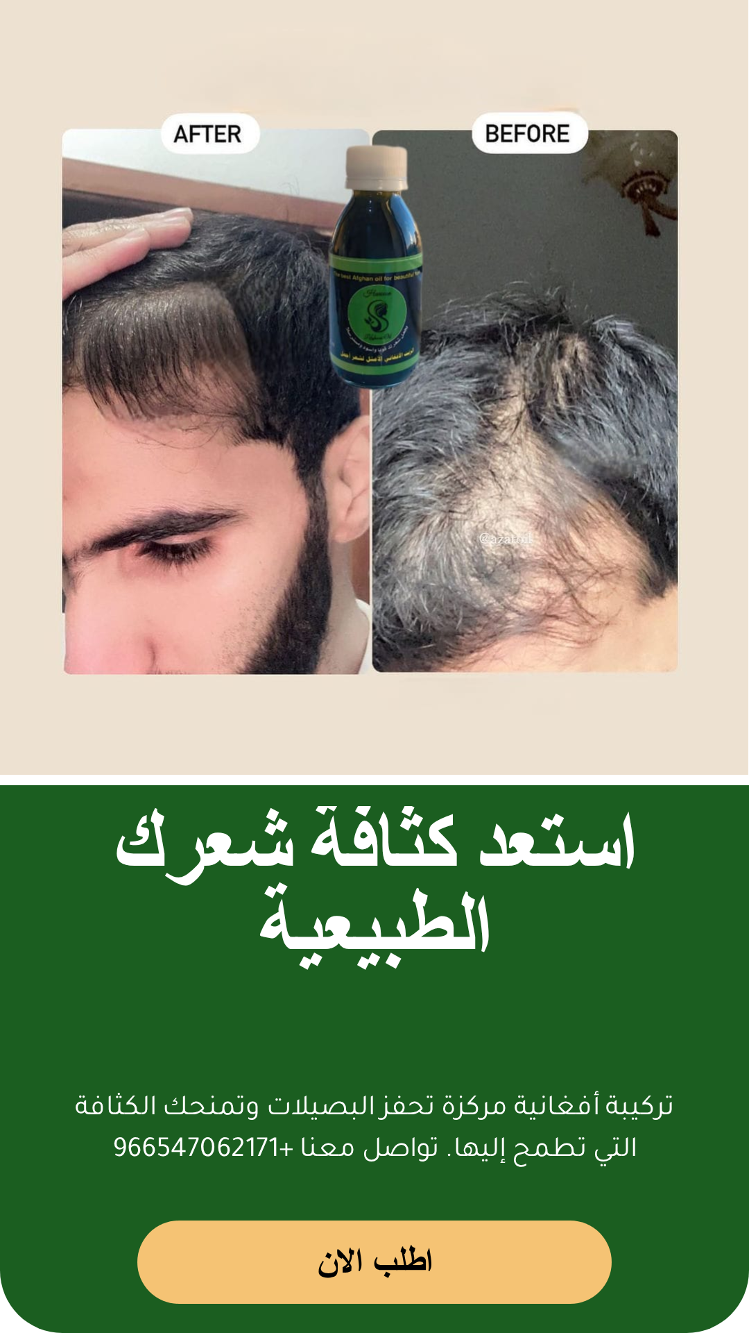 عرض زيت أفغاني محترف للعناية بالشعر مع مشط وشحن مجاني - الزيت الافغاني - متجر الزيت الافغاني الامثل للشعر